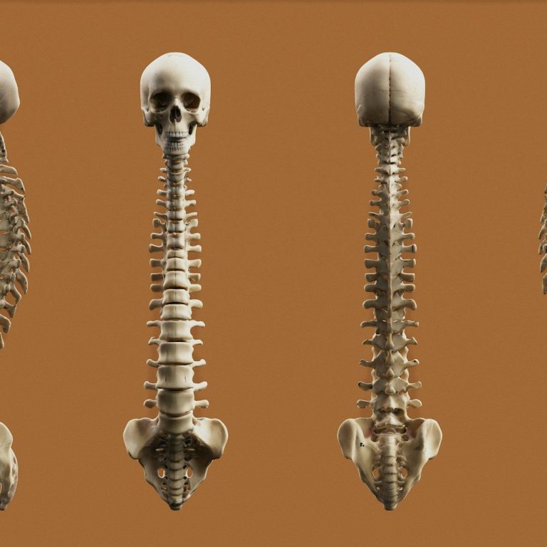 Lower back pain