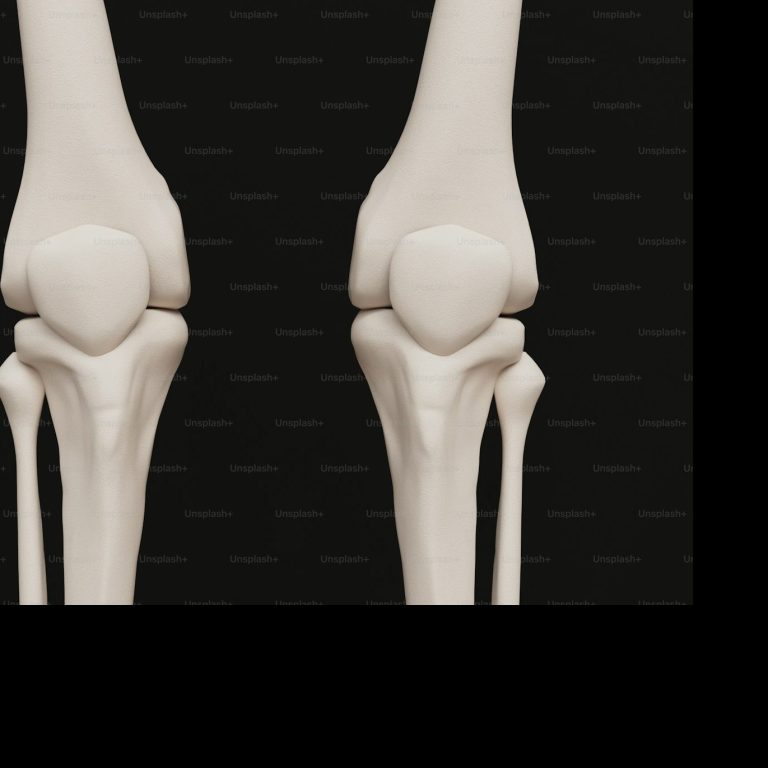 Knee pain